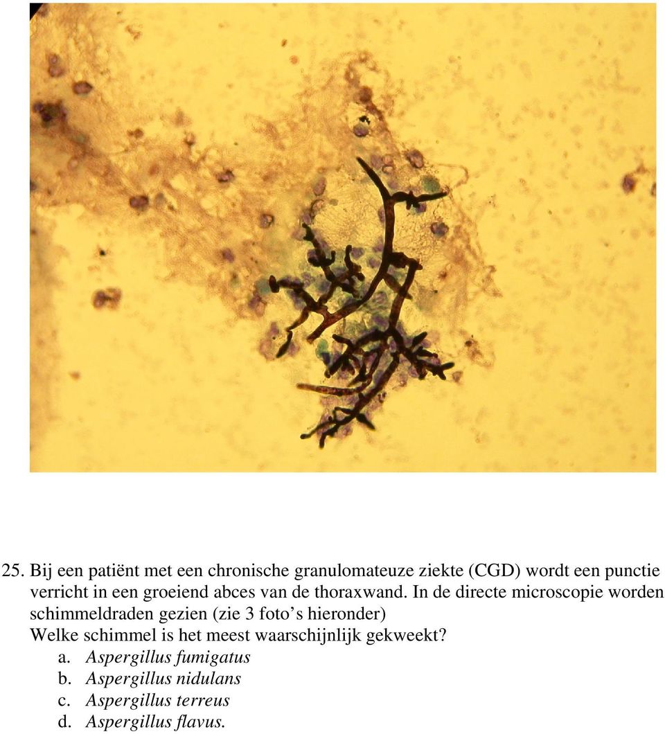 In de directe microscopie worden schimmeldraden gezien (zie 3 foto s hieronder) Welke