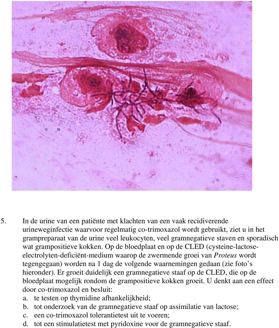 Op de bloedplaat en op de CLED (cysteine-lactoseelectrolyten-deficiënt-medium waarop de zwermende groei van Proteus wordt tegengegaan) worden na 1 dag de volgende waarnemingen gedaan (zie foto s