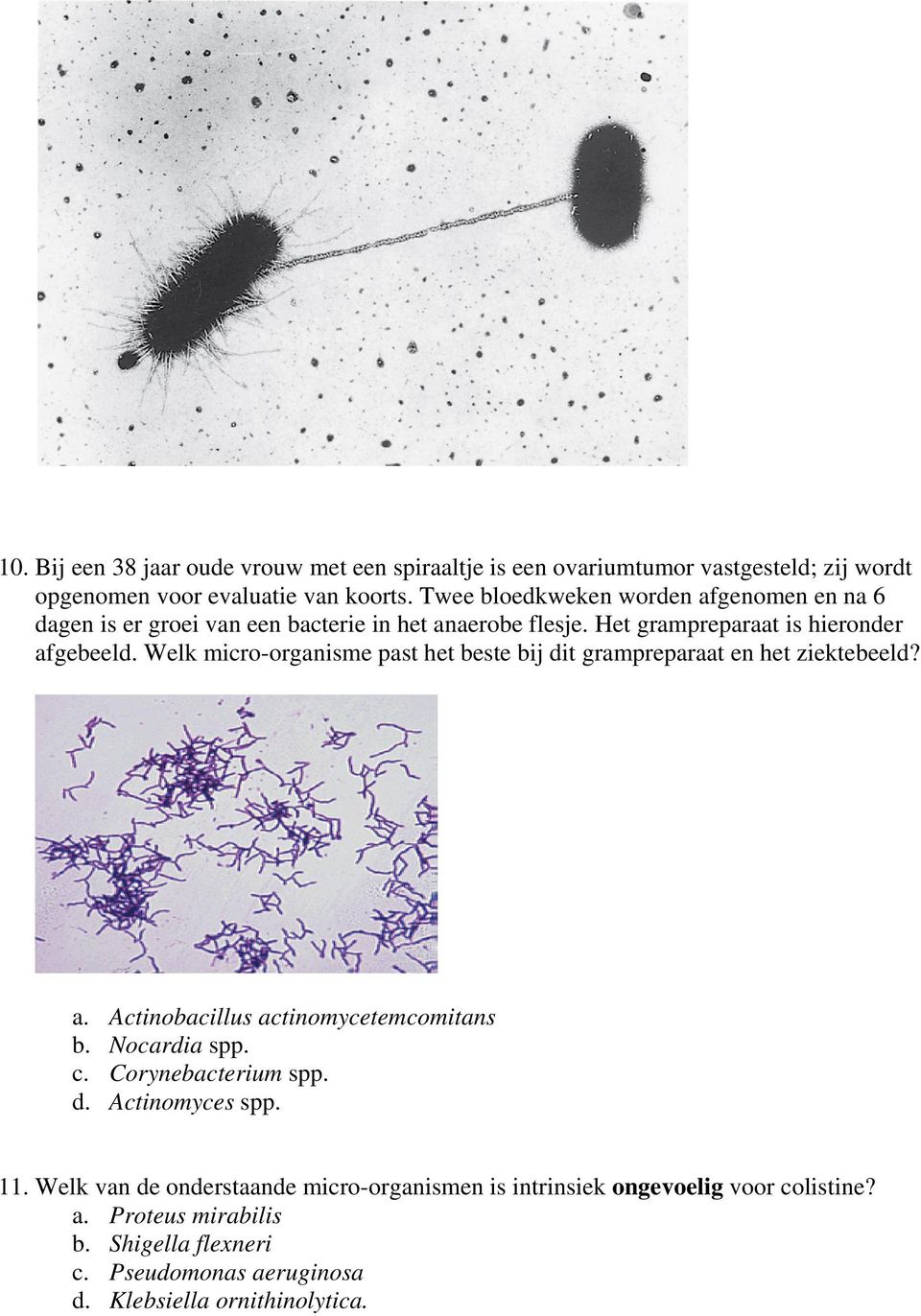 Welk micro-organisme past het beste bij dit grampreparaat en het ziektebeeld? a. Actinobacillus actinomycetemcomitans b. Nocardia spp. c. Corynebacterium spp.