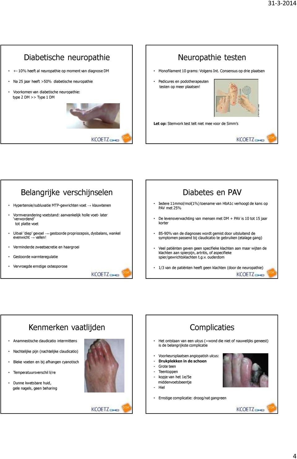 Let op: Stemvork test telt niet mee voor de Simm s Belangrijke verschijnselen Diabetes en PAV Hypertensie/subluxatie MTP-gewrichten voet klauwtenen Vormverandering voetstand: aanvankelijk holle voet-