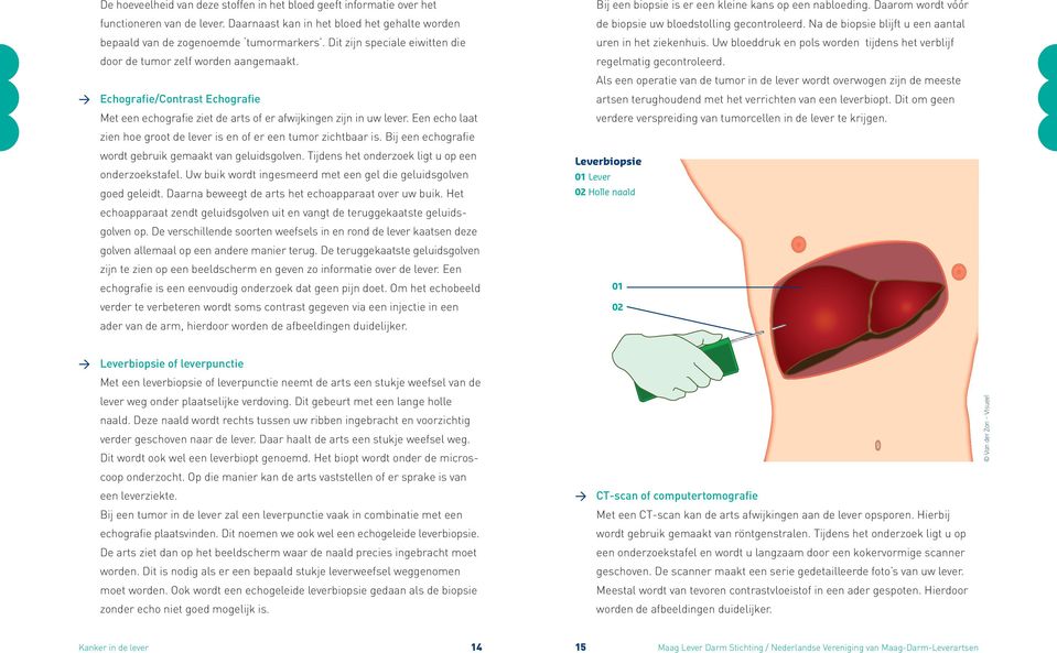 Een echo laat zien hoe groot de lever is en of er een tumor zichtbaar is. Bij een echografie wordt gebruik gemaakt van geluidsgolven. Tijdens het onderzoek ligt u op een onderzoekstafel.