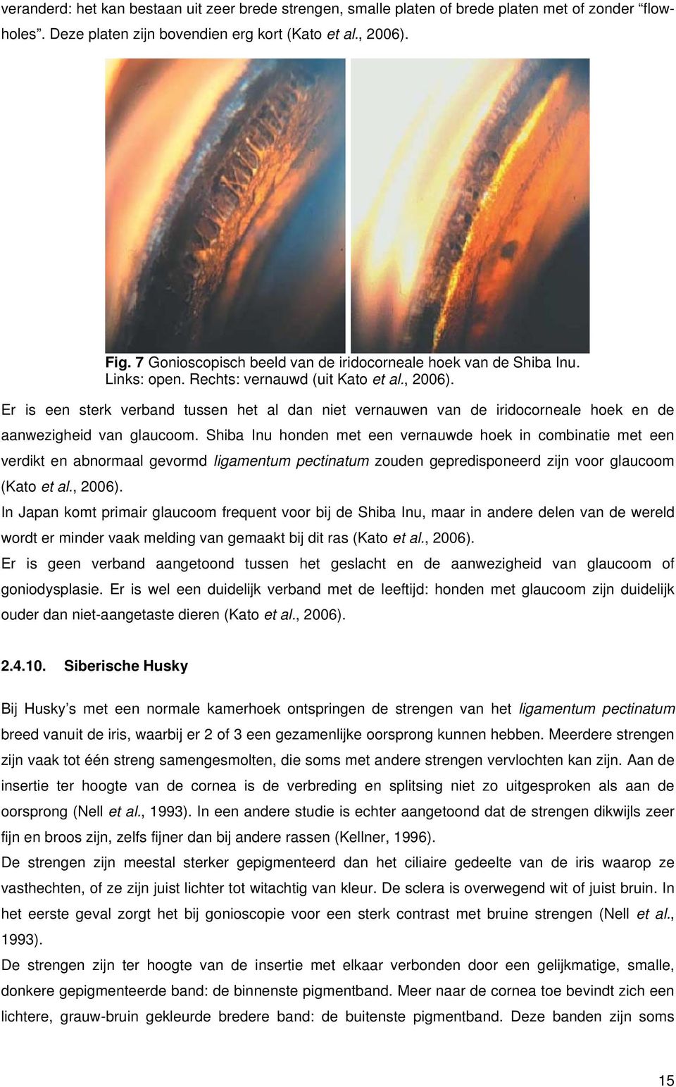 Er is een sterk verband tussen het al dan niet vernauwen van de iridocorneale hoek en de aanwezigheid van glaucoom.