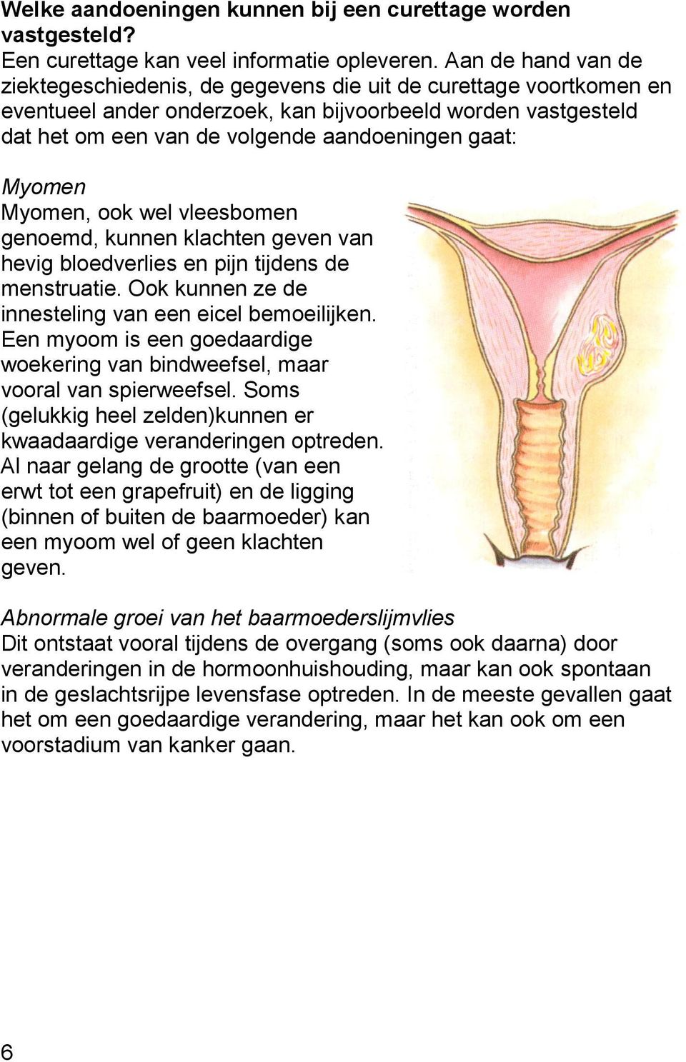 Myomen Myomen, ook wel vleesbomen genoemd, kunnen klachten geven van hevig bloedverlies en pijn tijdens de menstruatie. Ook kunnen ze de innesteling van een eicel bemoeilijken.