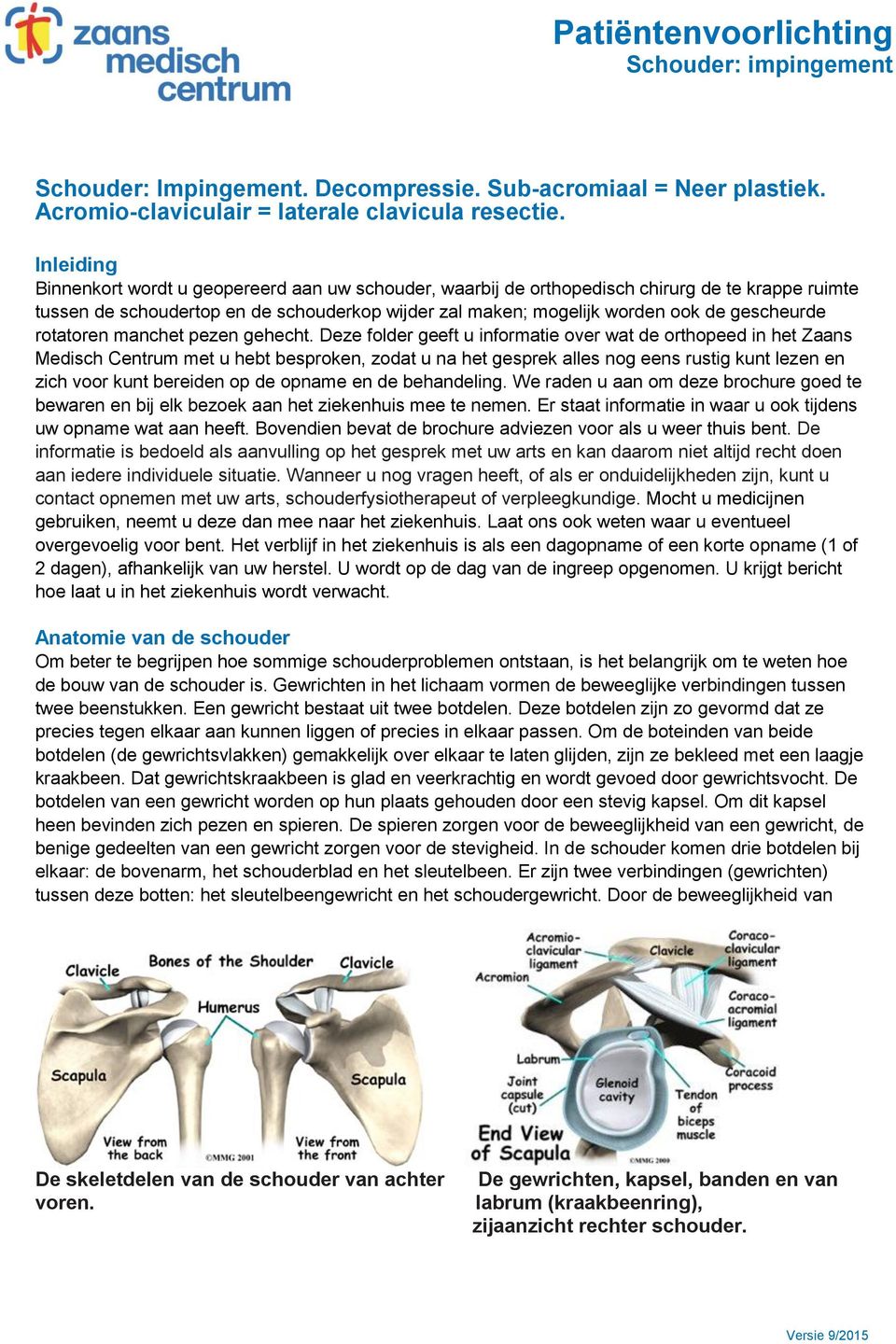 gescheurde rotatoren manchet pezen gehecht.