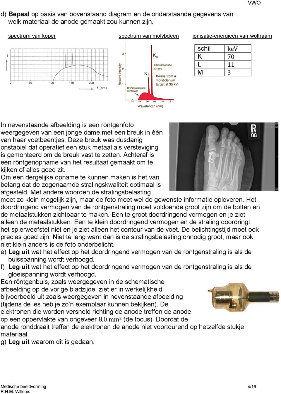 van haar voetbeentjes. Deze breuk was dusdanig onstabiel dat operatief een stuk metaal als versteviging is gemonteerd om de breuk vast te zetten.