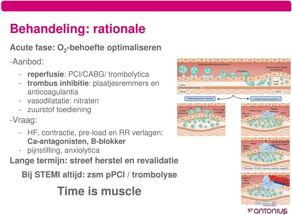 zuurstof toediening -Vraag: - HF, contractie, pre-load en RR verlagen: Ca-antagonisten, B-blokker -