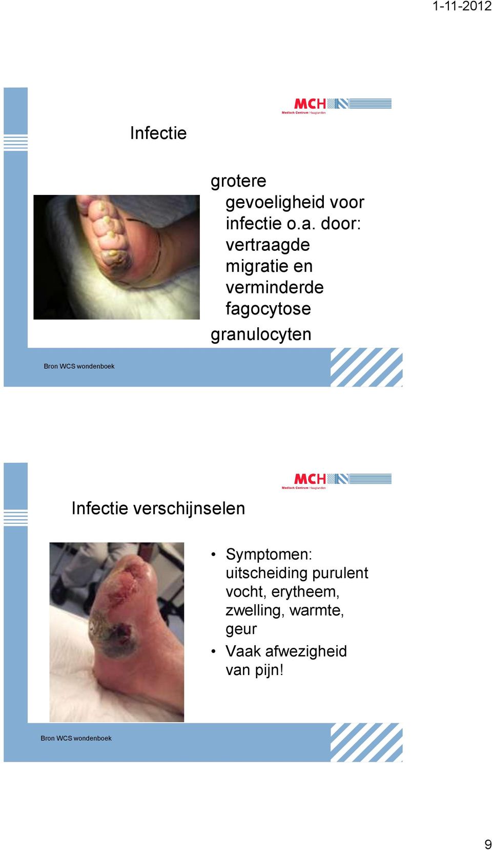 WCS wondenboek Infectie verschijnselen Symptomen: uitscheiding