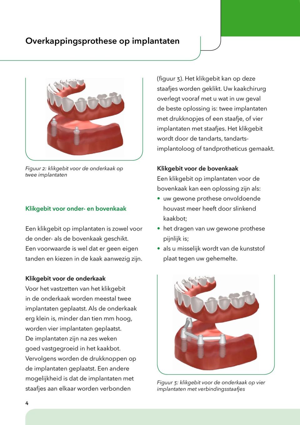 Het klikgebit wordt door de tandarts, tandartsimplantoloog of tandprotheticus gemaakt.