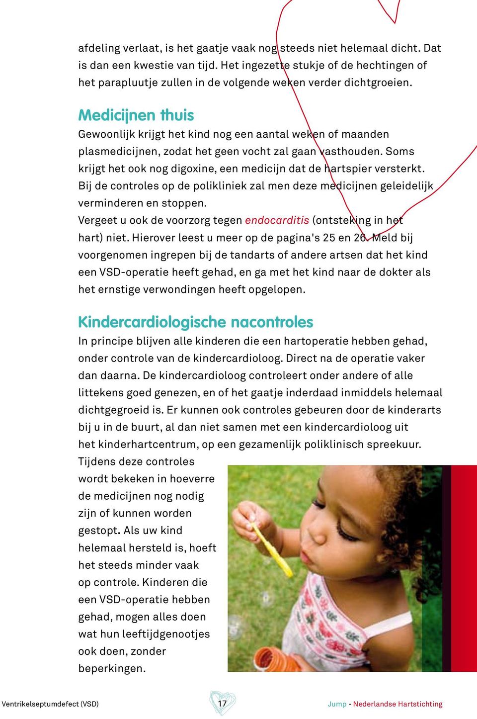 Medicijnen thuis Gewoonlijk krijgt het kind nog een aantal weken of maanden plasmedicijnen, zodat het geen vocht zal gaan vasthouden.