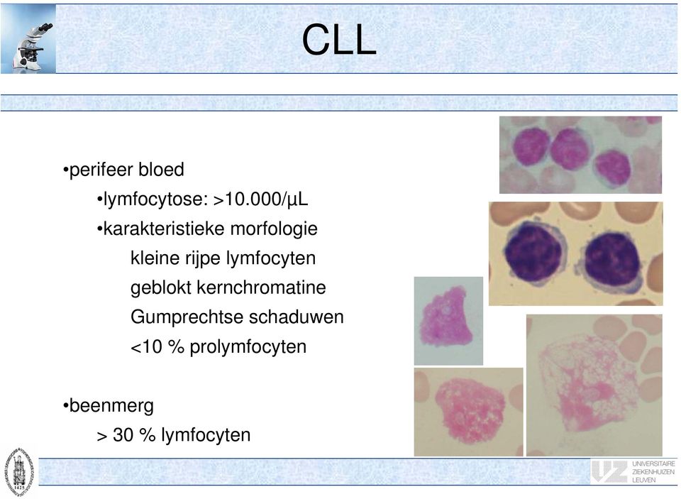 lymfocyten geblokt kernchromatine Gumprechtse