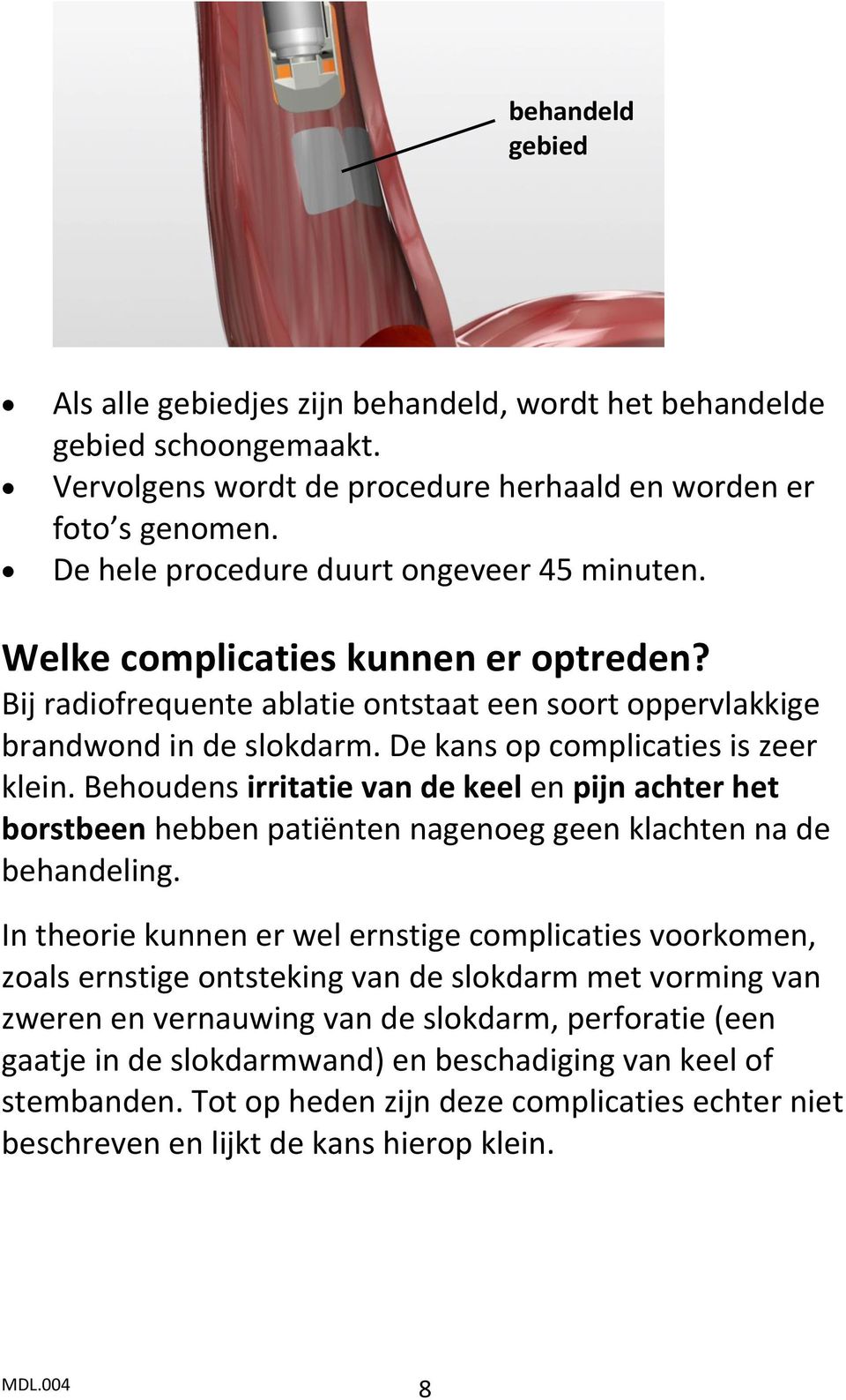 De kans op complicaties is zeer klein. Behoudens irritatie van de keel en pijn achter het borstbeen hebben patiënten nagenoeg geen klachten na de behandeling.