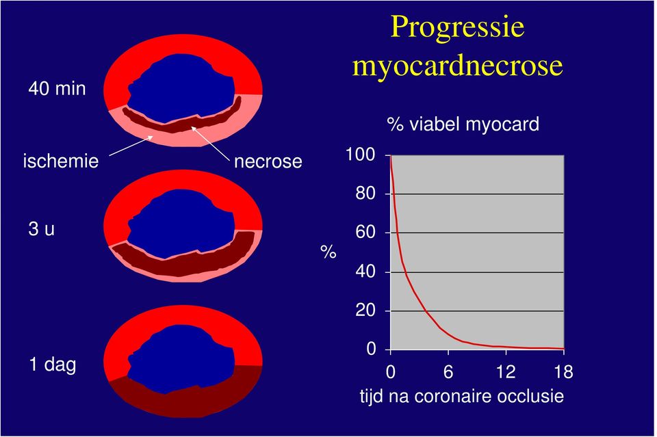 myocard 3 u 1 dag % 60 40 20 0 0