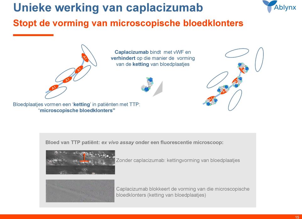 TTP: micrscpische bledklnters Bled van TTP patiënt: ex viv assay nder een flurescentie micrscp: Znder caplacizumab: