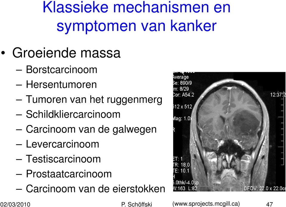 Schildkliercarcinoom Carcinoom van de galwegen Levercarcinoom