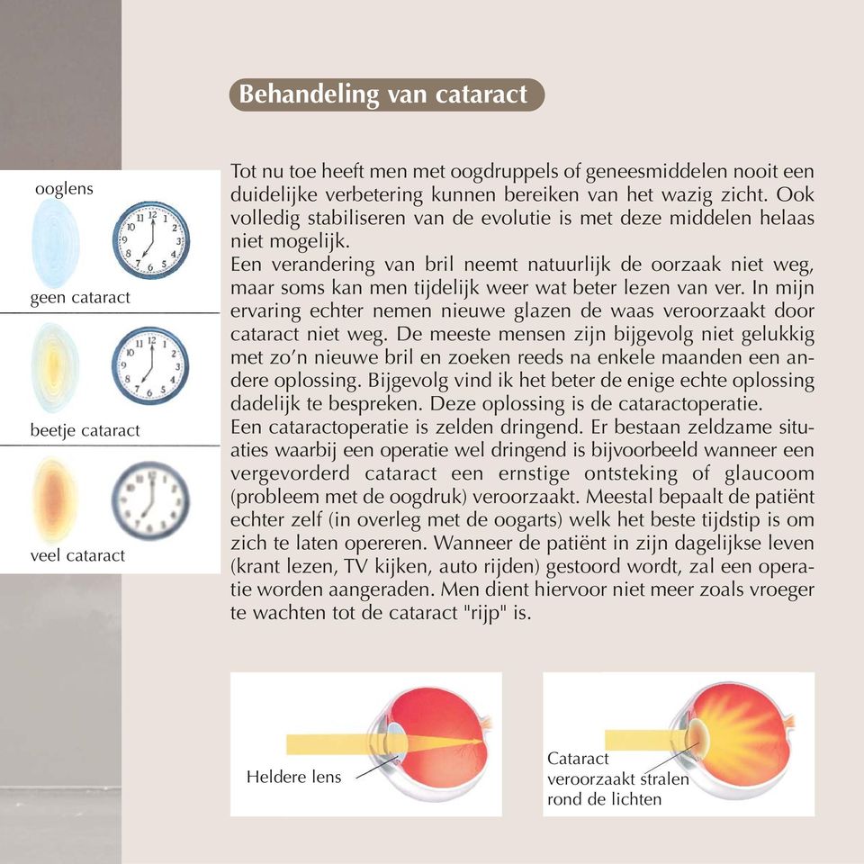 Een verandering van bril neemt natuurlijk de oorzaak niet weg, maar soms kan men tijdelijk weer wat beter lezen van ver.