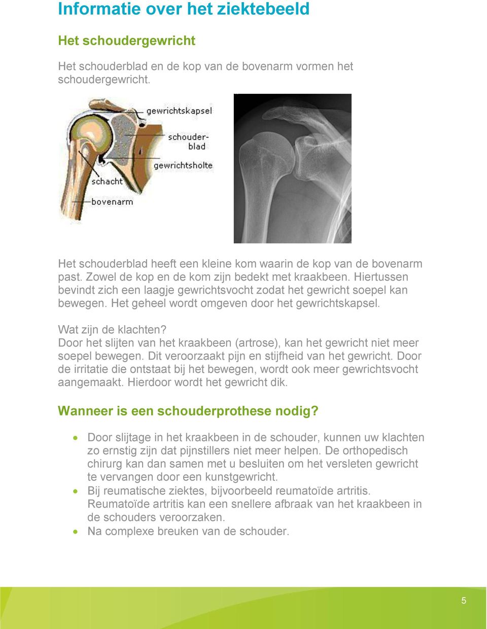 Wat zijn de klachten? Door het slijten van het kraakbeen (artrose), kan het gewricht niet meer soepel bewegen. Dit veroorzaakt pijn en stijfheid van het gewricht.