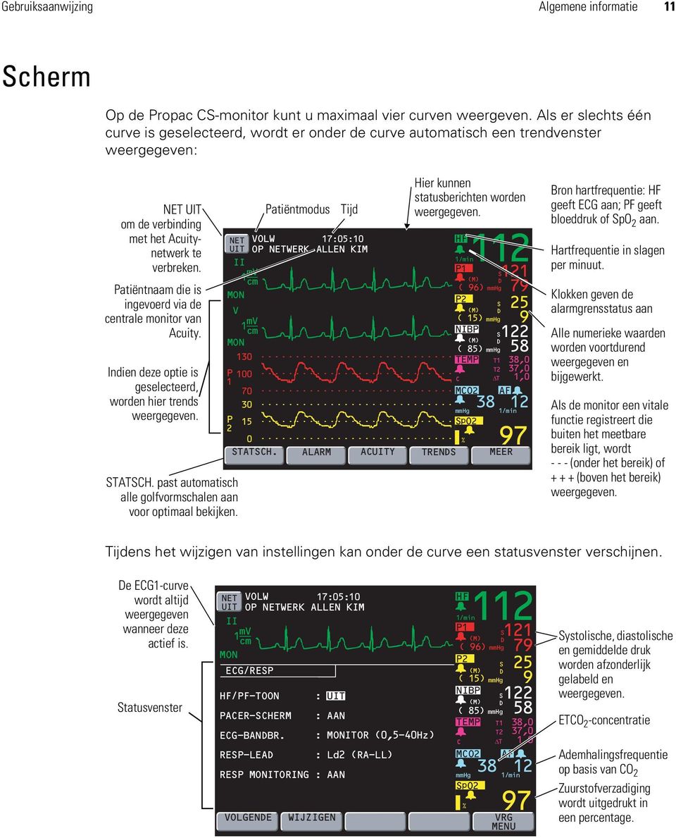 Patiëntnaam die is ingevoerd via de centrale monitor van Acuity. Indien deze optie is geselecteerd, worden hier trends weergegeven. STATSCH.