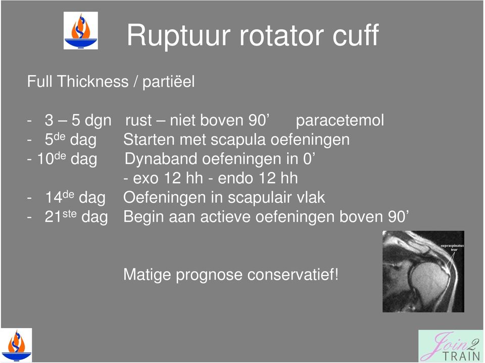 oefeningen in 0 - exo 12 hh - endo 12 hh - 14 de dag Oefeningen in scapulair