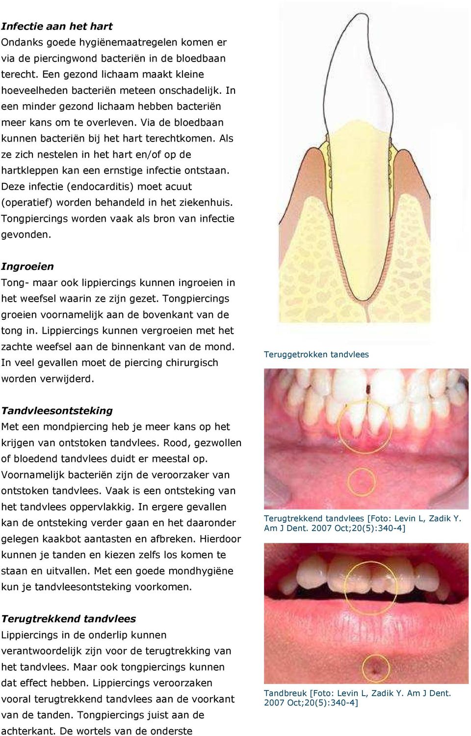 Als ze zich nestelen in het hart en/of op de hartkleppen kan een ernstige infectie ontstaan. Deze infectie (endocarditis) moet acuut (operatief) worden behandeld in het ziekenhuis.