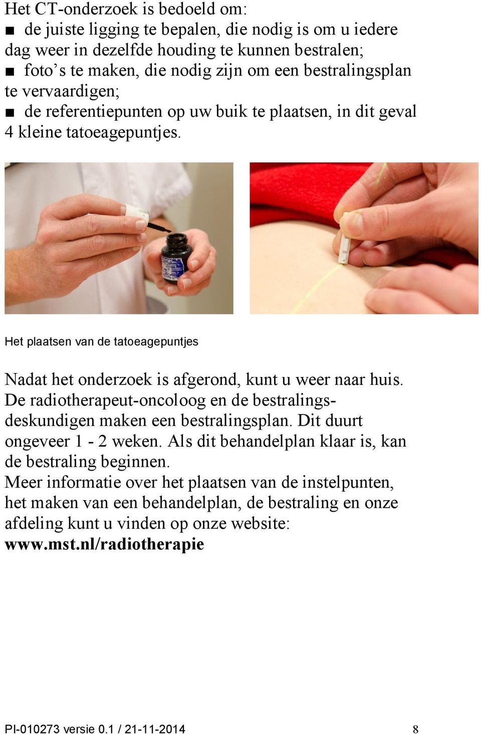 De radiotherapeut-oncoloog en de bestralingsdeskundigen maken een bestralingsplan. Dit duurt ongeveer 1-2 weken. Als dit behandelplan klaar is, kan de bestraling beginnen.