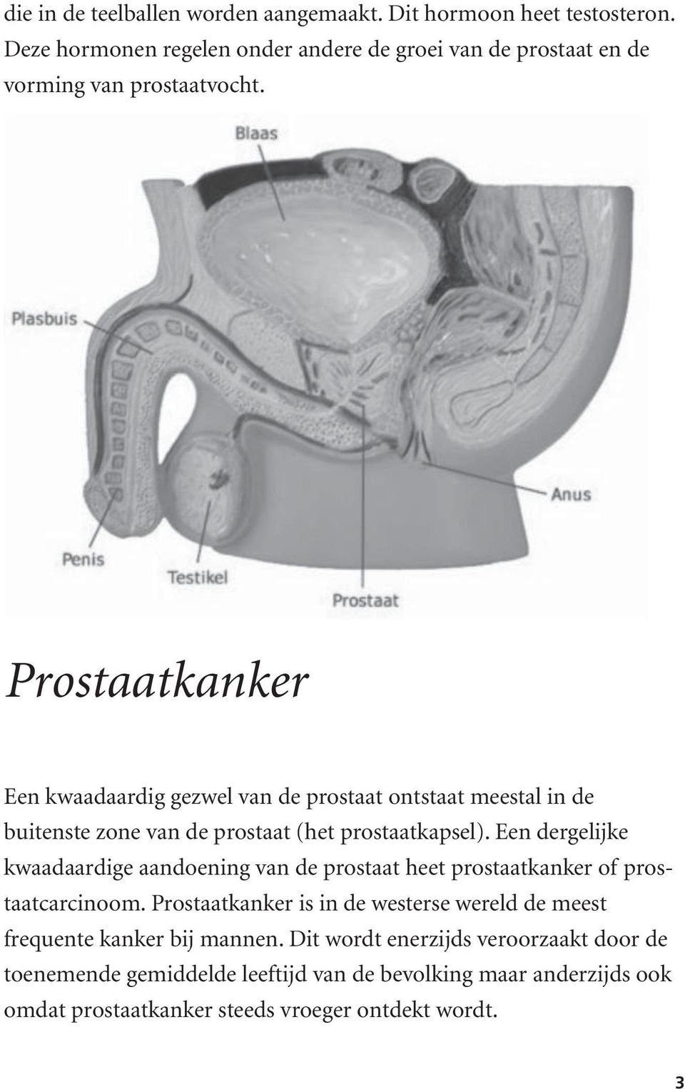 Prostaatkanker Een kwaadaardig gezwel van de prostaat ontstaat meestal in de buitenste zone van de prostaat (het prostaatkapsel).