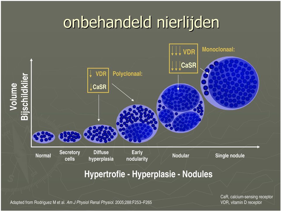 nodule Hypertrofie - Hyperplasie - Nodules Adapted from Rodriguez M et al.