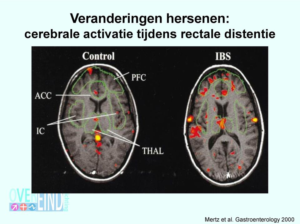 tijdens rectale distentie