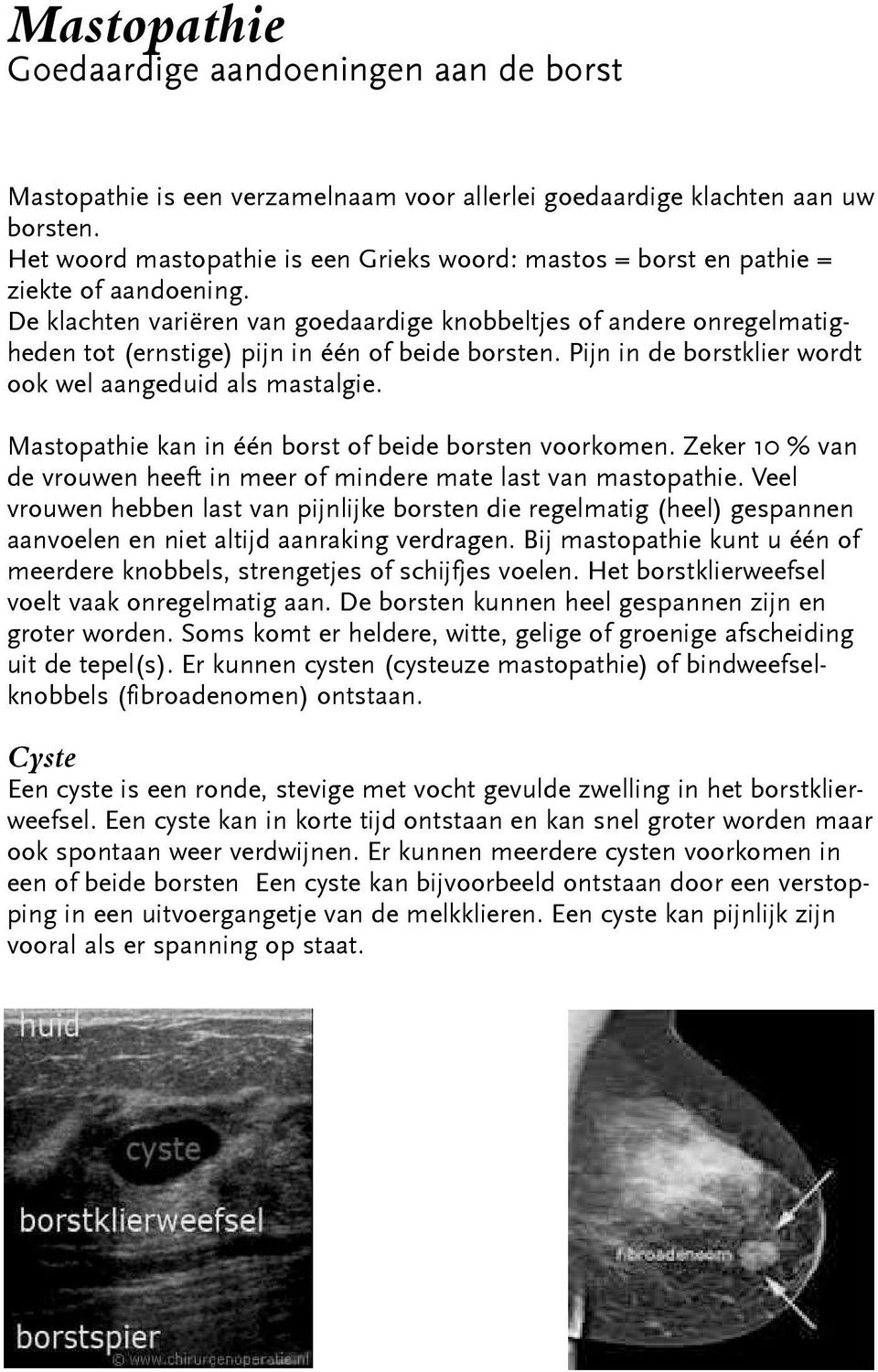 De klachten variëren van goedaardige knobbeltjes of andere onregelmatigheden tot (ernstige) pijn in één of beide borsten. Pijn in de borstklier wordt ook wel aangeduid als mastalgie.