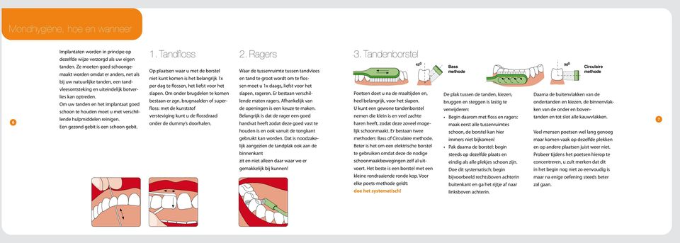 Om uw tanden en het implantaat goed schoon te houden moet u met verschillende hulpmiddelen reinigen. Een gezond gebit is een schoon gebit. 1.