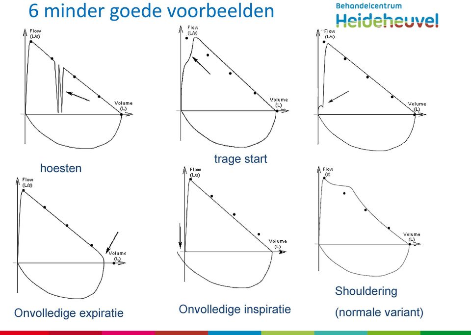 Onvolledige expiratie