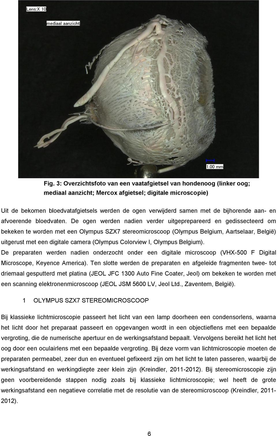 De ogen werden nadien verder uitgeprepareerd en gedissecteerd om bekeken te worden met een Olympus SZX7 stereomicroscoop (Olympus Belgium, Aartselaar, België) uitgerust met een digitale camera