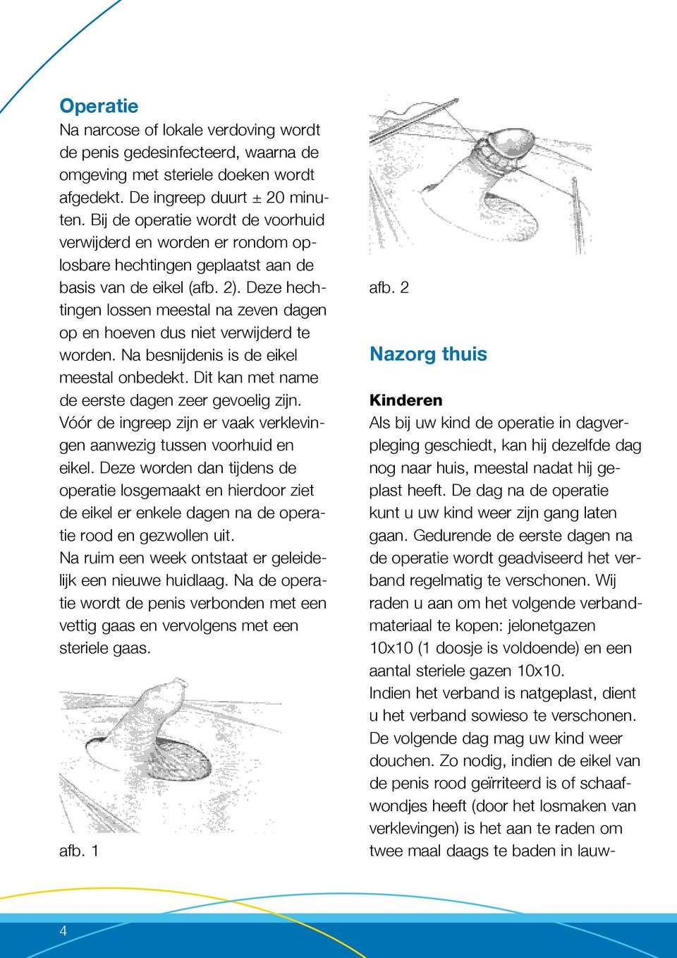 Deze hechtingen lossen meestal na zeven dagen op en hoeven dus niet verwijderd te worden. Na besnijdenis is de eikel meestal onbedekt. Dit kan met name de eerste dagen zeer gevoelig zijn.