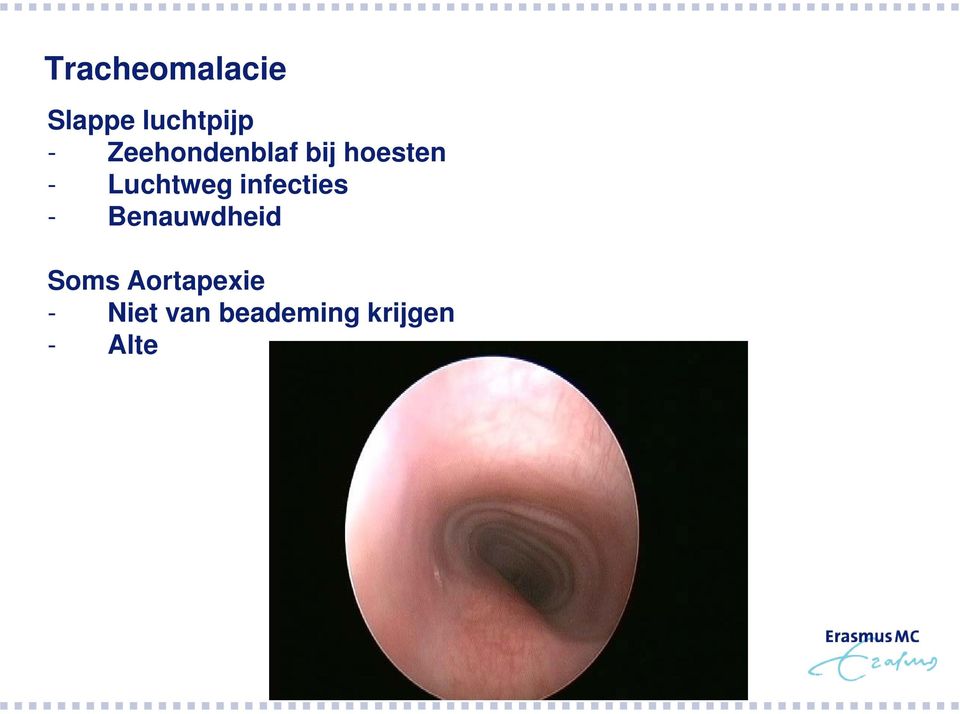 infecties - Benauwdheid Soms