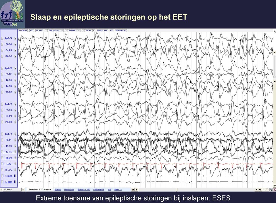 Extreme toename van