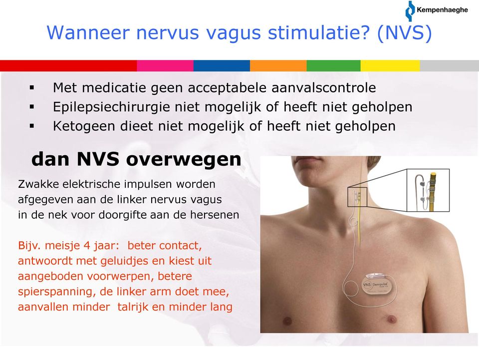 niet mogelijk of heeft niet geholpen dan NVS overwegen Zwakke elektrische impulsen worden afgegeven aan de linker nervus vagus