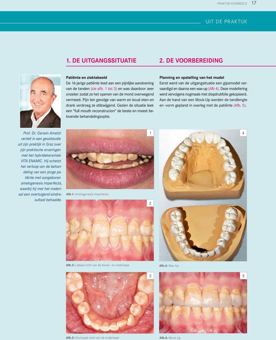 Gezien de situatie leek een "full mouth reconstrucion" de beste en meest belovende behandelingsoptie.