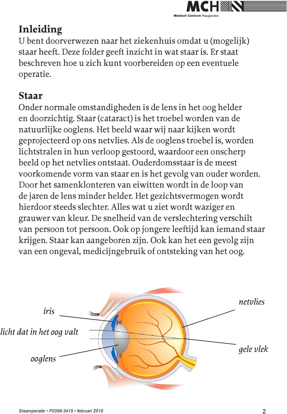 Het beeld waar wij naar kijken wordt geprojecteerd op ons netvlies. Als de ooglens troebel is, worden lichtstralen in hun verloop gestoord, waardoor een onscherp beeld op het netvlies ontstaat.