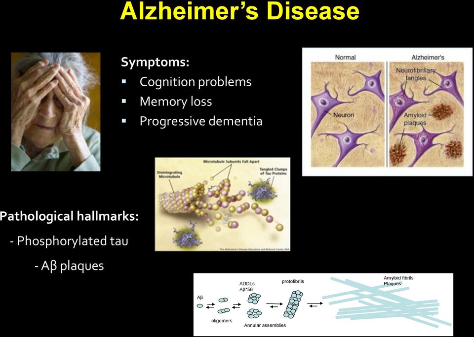 hallmarks: - Phosphorylated tau - Aβ plaques Aβ ADDLs