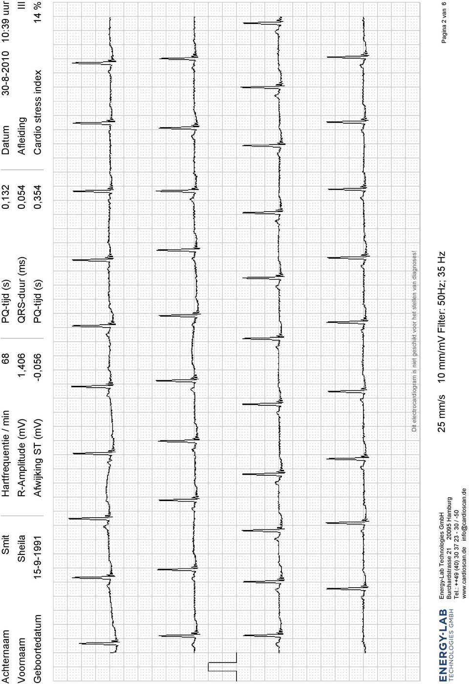 electrocardiogram is niet geschikt voor het stellen van diagnoses!