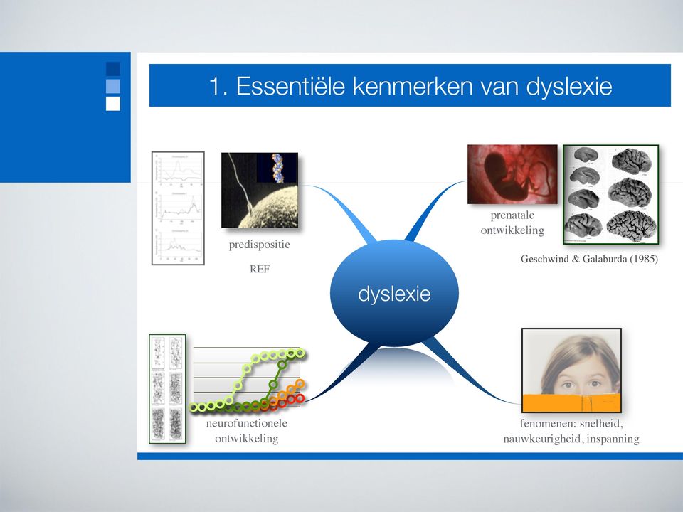 ontwikkeling Geschwind & Galaburda (1985)