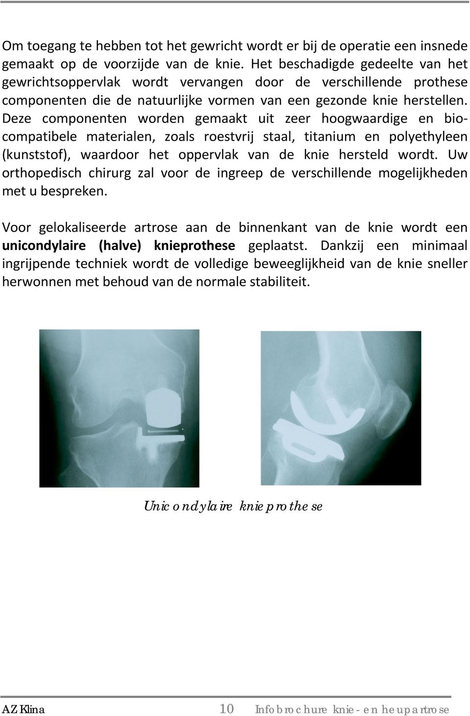 Deze componenten worden gemaakt uit zeer hoogwaardige en biocompatibele materialen, zoals roestvrij staal, titanium en polyethyleen (kunststof), waardoor het oppervlak van de knie hersteld wordt.