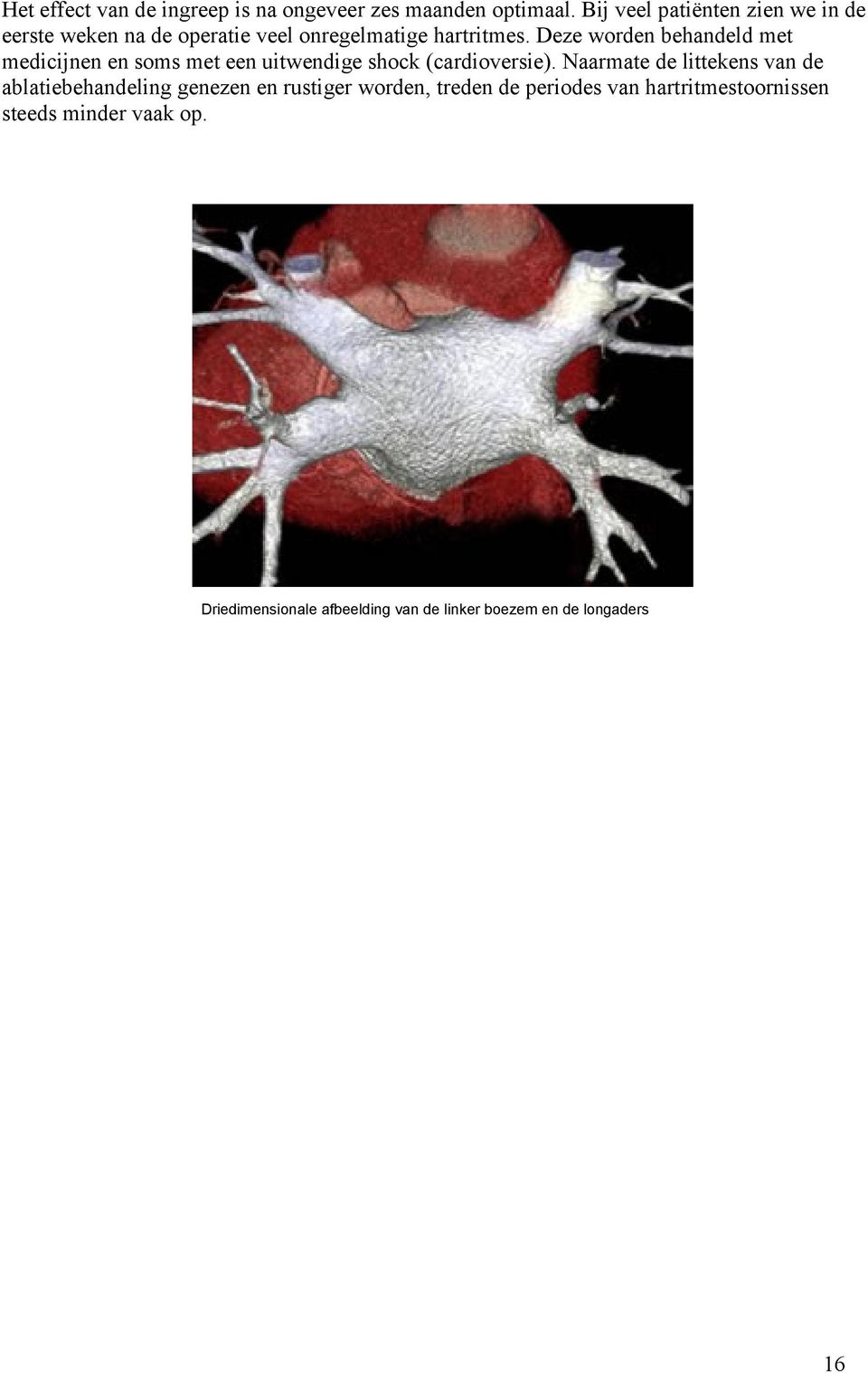 Deze worden behandeld met medicijnen en soms met een uitwendige shock (cardioversie).