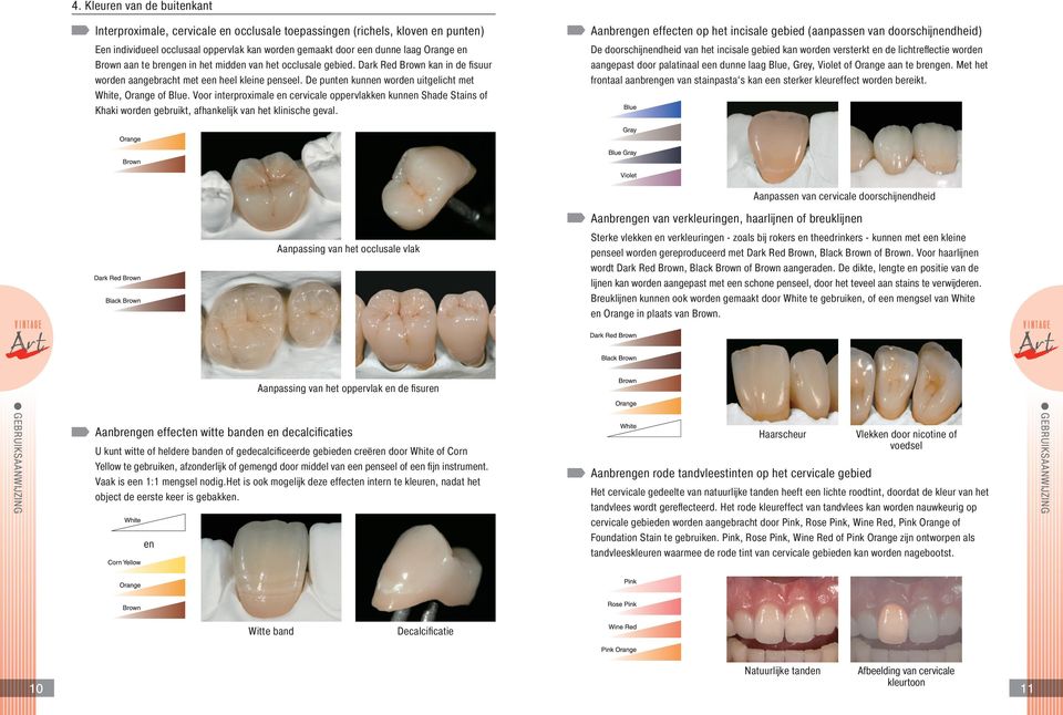 Voor interproximale en cervicale oppervlakken kunnen Shade Stains of Khaki worden gebruikt, afhankelĳ k van het klinische geval.