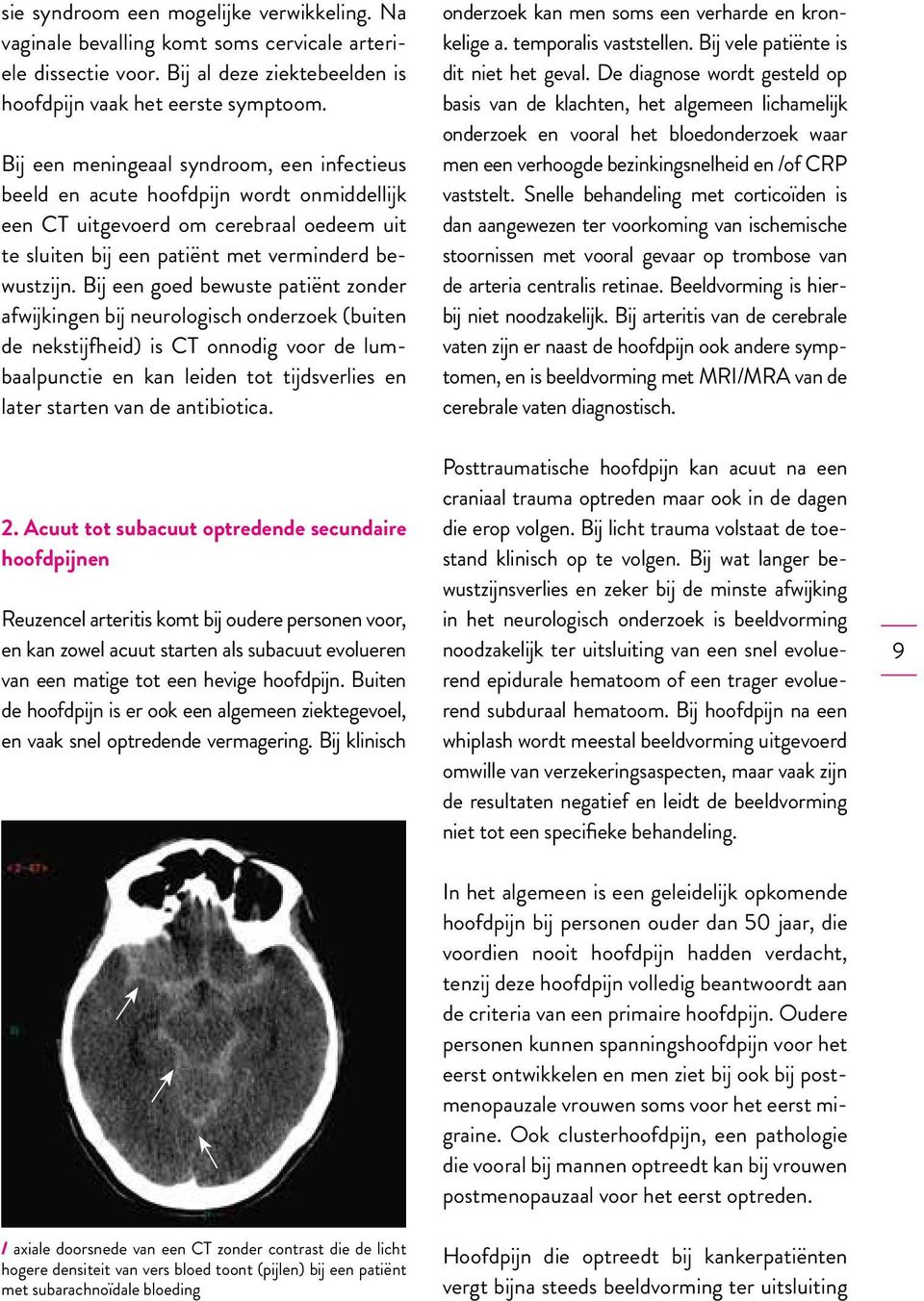 Bij een goed bewuste patiënt zonder afwijkingen bij neurologisch onderzoek (buiten de nekstijfheid) is CT onnodig voor de lumbaalpunctie en kan leiden tot tijdsverlies en later starten van de