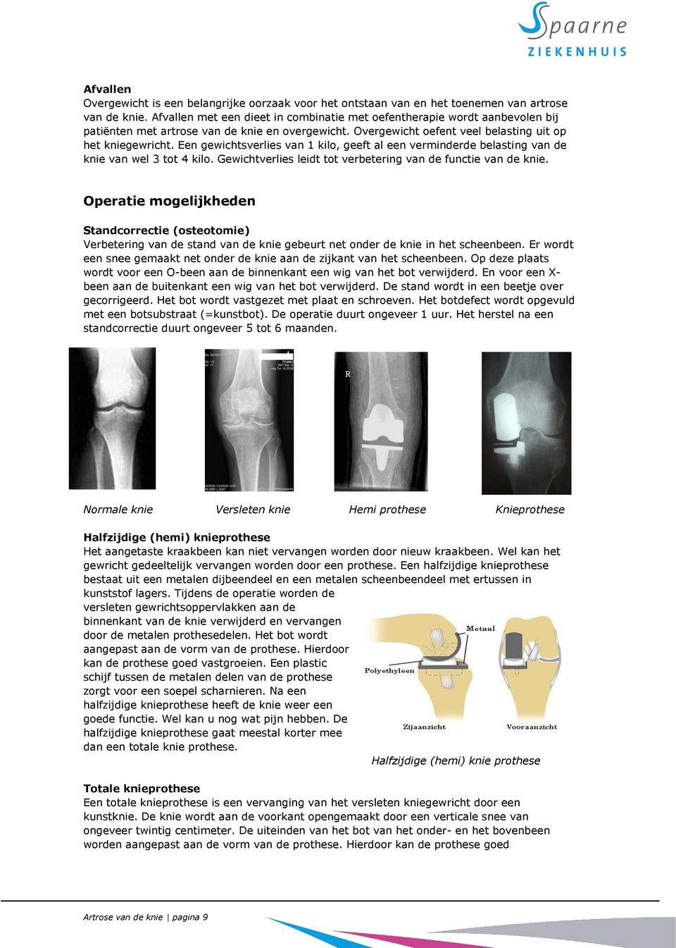 Een gewichtsverlies van 1 kilo, geeft al een verminderde belasting van de knie van wel 3 tot 4 kilo. Gewichtverlies leidt tot verbetering van de functie van de knie.