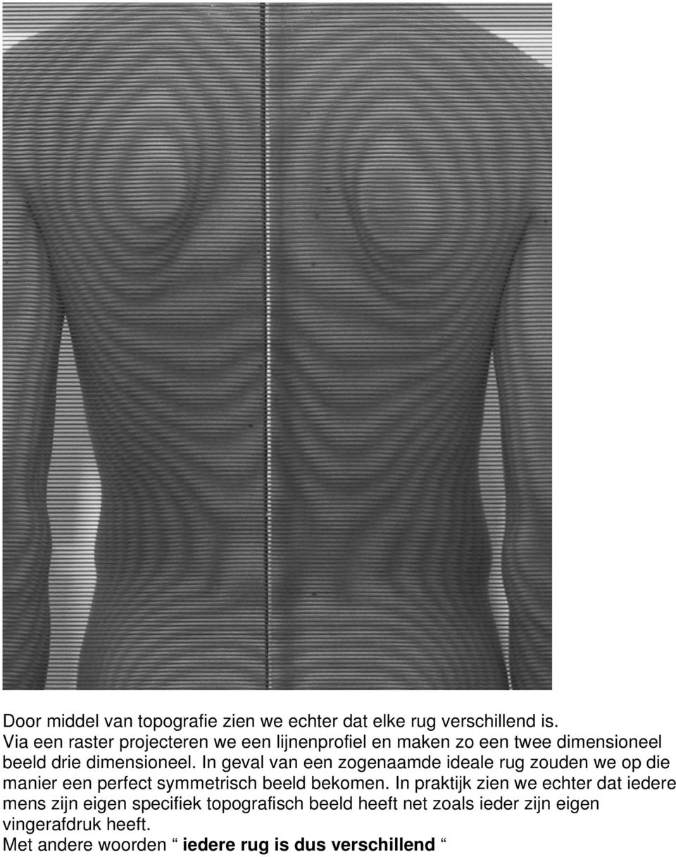 In geval van een zogenaamde ideale rug zouden we op die manier een perfect symmetrisch beeld bekomen.