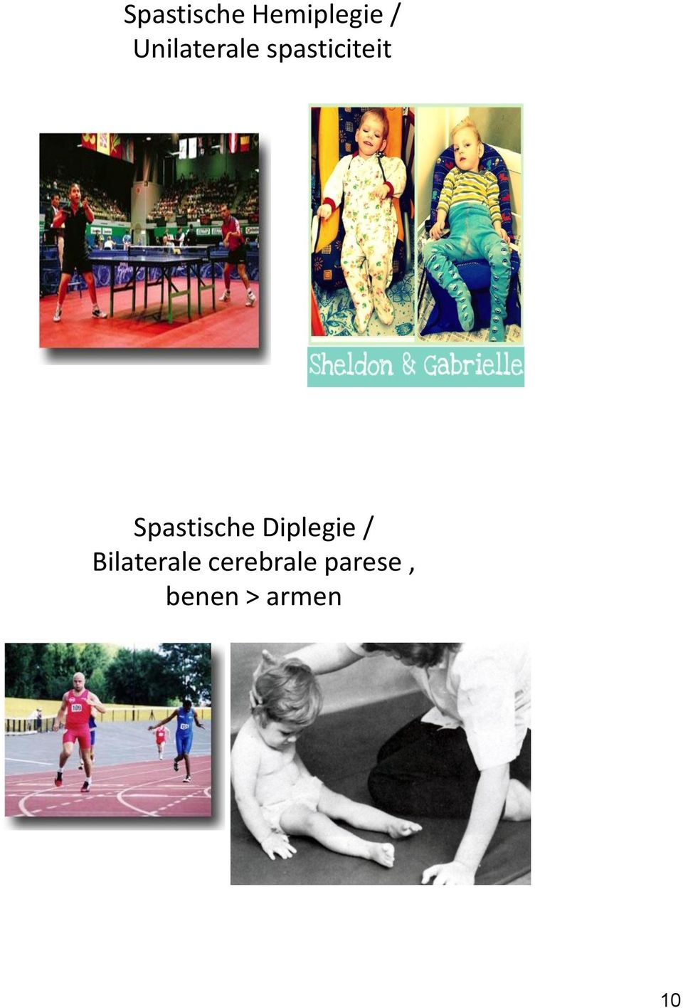 Spastische Diplegie /