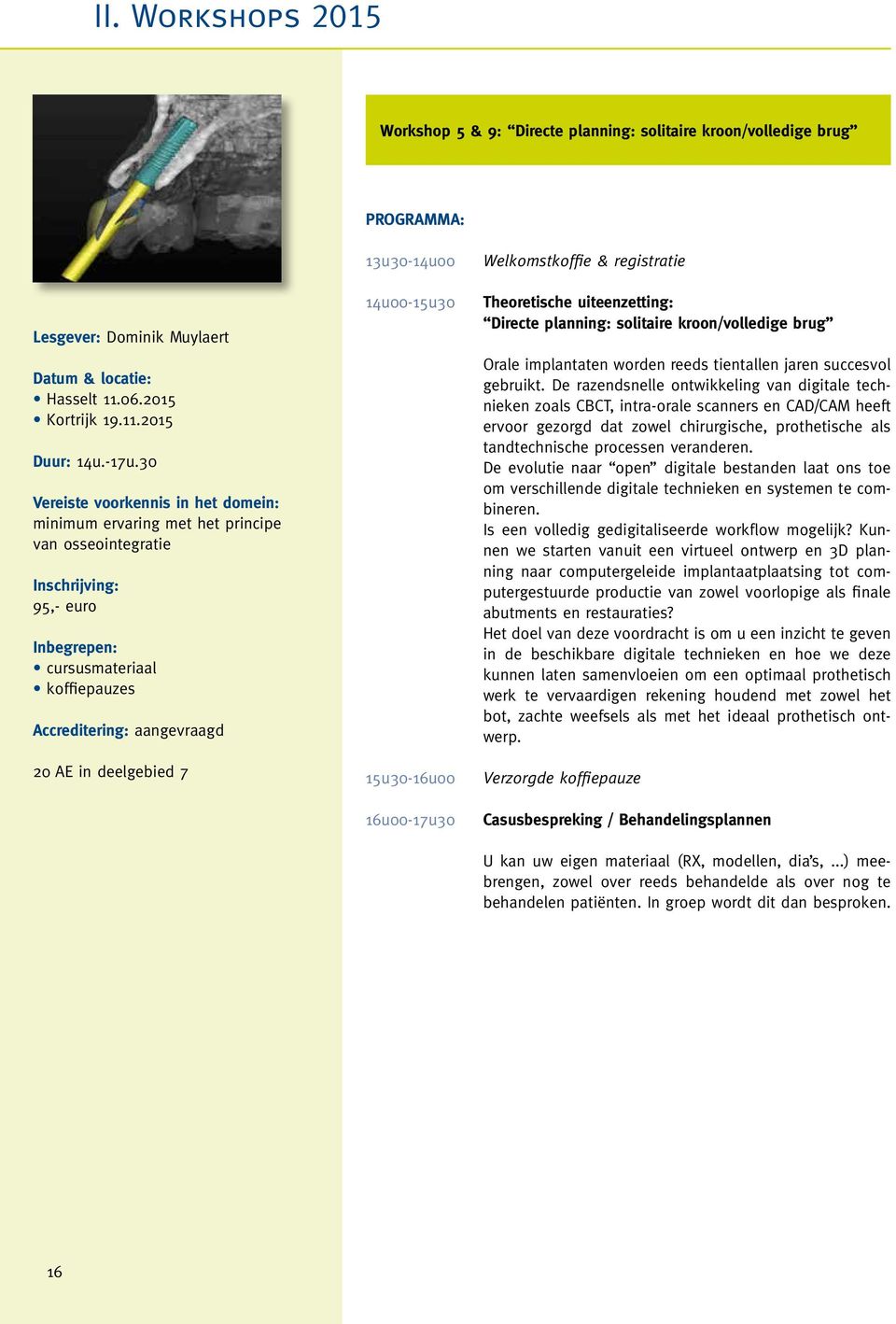 deelgebied 7 13u30-14u00 14u00-15u30 15u30-16u00 16u00-17u30 Welkomstkoffie & registratie Theoretische uiteenzetting: Directe planning: solitaire kroon/volledige brug Orale implantaten worden reeds