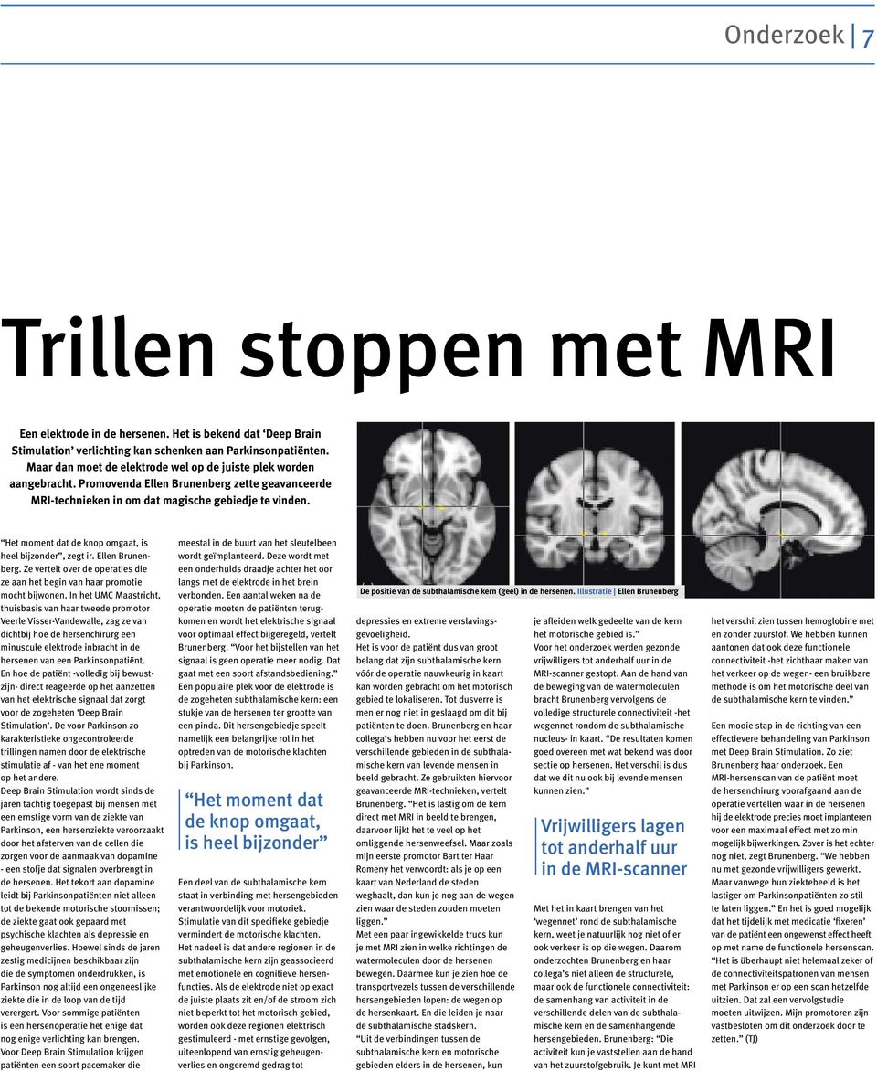 Het moment dat de knop omgaat, is heel bijzonder, zegt ir. Ellen Brunenberg. Ze vertelt over de operaties die ze aan het begin van haar promotie mocht bijwonen.