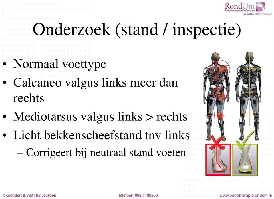 Mediotarsus valgus links > rechts Licht